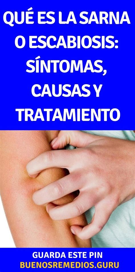 Qué Es La Sarna O Escabiosis Síntomas Causas Y Tratamiento Buenos