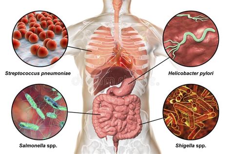 Salmonellosis Human Intestines And Bacterium That Cause This Disease