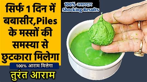 Bawaseer Ka Ilaj Piles Treatment At Home In Hindi Bawaseer Ka Ilaj In Hindi Piles Ka Ilaj Piles