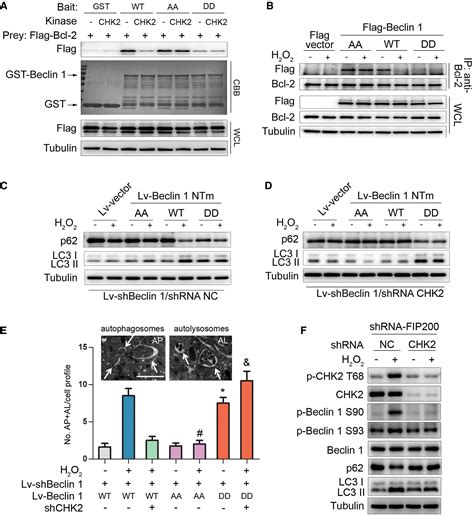 Atmchk Beclin Axis Promotes Autophagy To Maintain Ros Homeostasis