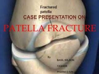 Fracture Of Patella Pptx