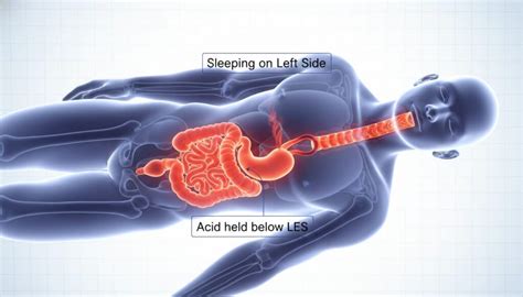 side     sleep    clinical guide