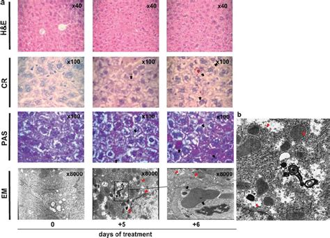 Time Dependent Histological And Ultrastructural Effects Of Bortezomib