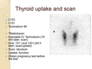 thyroid gland  disease  thyroid gland