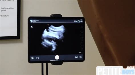 Ultrasound Anal Fuck By Doctor For Skinny Stud In Infirmary