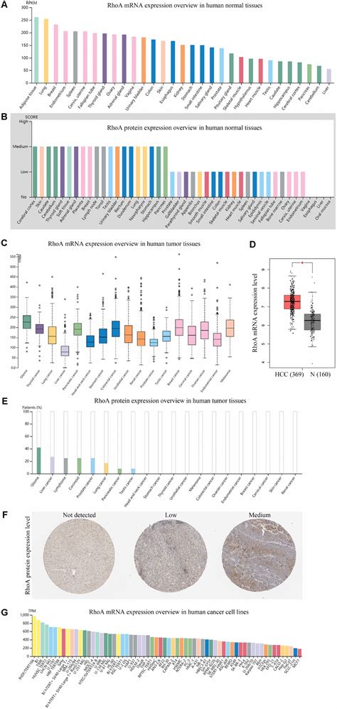 The Diagnostic And Prognostic Role Of RhoA In Hepatocellular Carcinoma