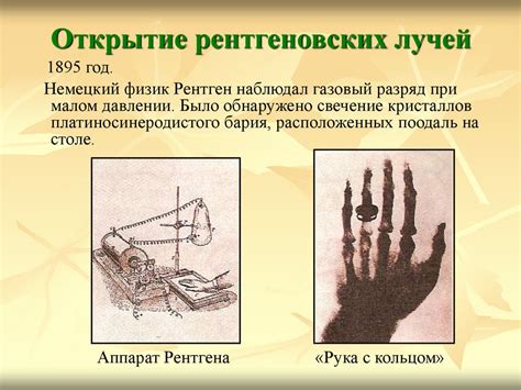Рентгеновское излучение. Открытие рентгеновских лучей - online presentation