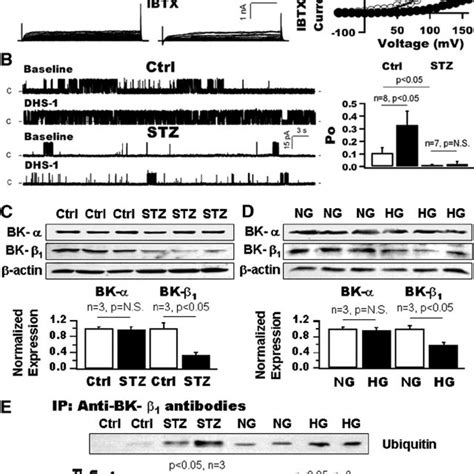 Impaired BK- ␤ 1 function and | Download Scientific Diagram
