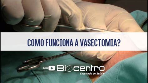 Como E Feita A Cirurgia De Vasectomia - ZULEDU