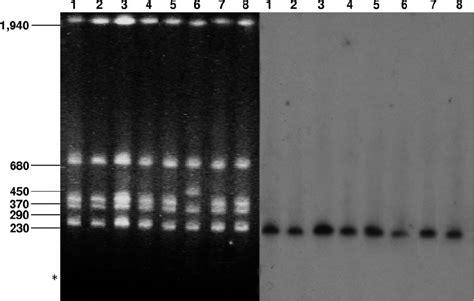 Pfge Profiles Of Genomic Dnas Of The Eight P Mirabilis Isolates After