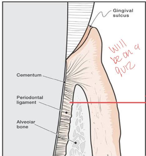 Perio Quiz 3 Diseases Of The Periodontium Flashcards Quizlet