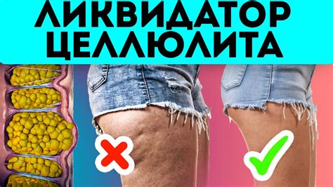 eto pomnozhit tsellyulit na nol youtube