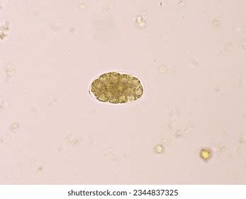 Hookworms In Stool In Humans