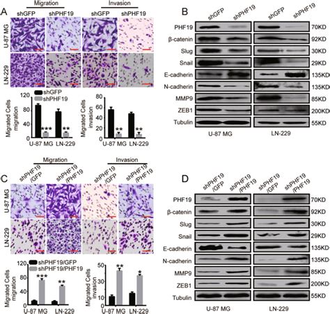 Phf Promotes The Proliferation Migration And Chemosensitivity Of