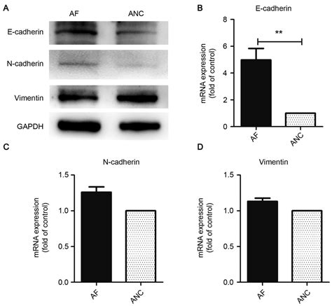 Expression Levels Of E Cadherin N Cadherin And Vimentin A Download Scientific Diagram