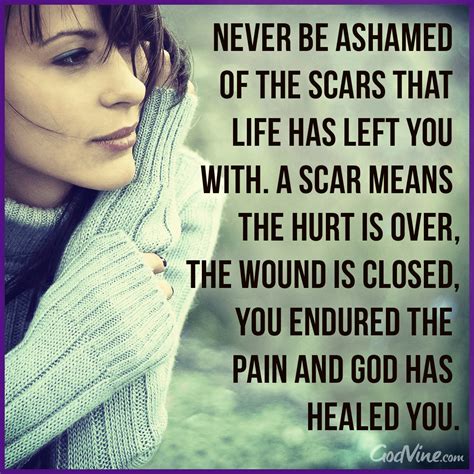 Scars Healing Quotes At Andrew Randy Blog
