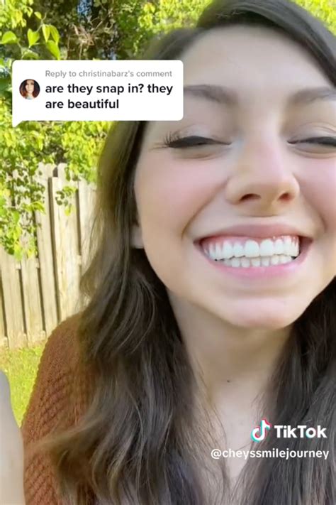 I M A Toothless Babe Who Needs Dentures At 30 I M Raising Funds For New Real Teeth