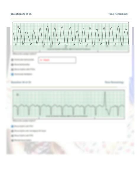 Relias Dysrhythmia Basic A Test Answers 2024 Solution Relia