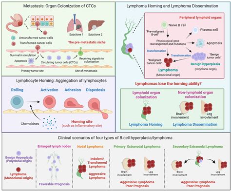 Frontiers Lymphoma Dissemination Is A Pathological Hallmark For Malignant Progression Of B