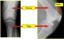 Dr Craig J Della Valle Hip And Knee Surgeon Basic Knee Anatomy Dr