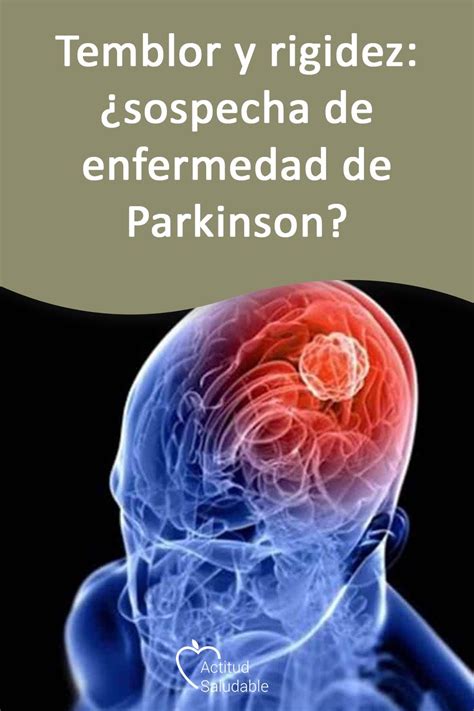 Temblor Y Rigidez Sospecha De Enfermedad De Parkinson Enfermedad De