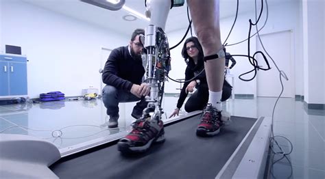 bionic prosthetic legs modern technology expands horizons