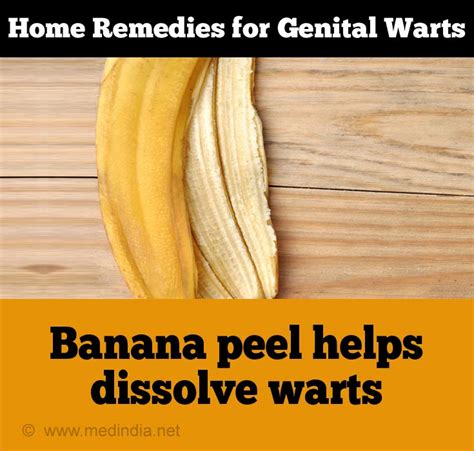 Home Remedies For Genital Warts