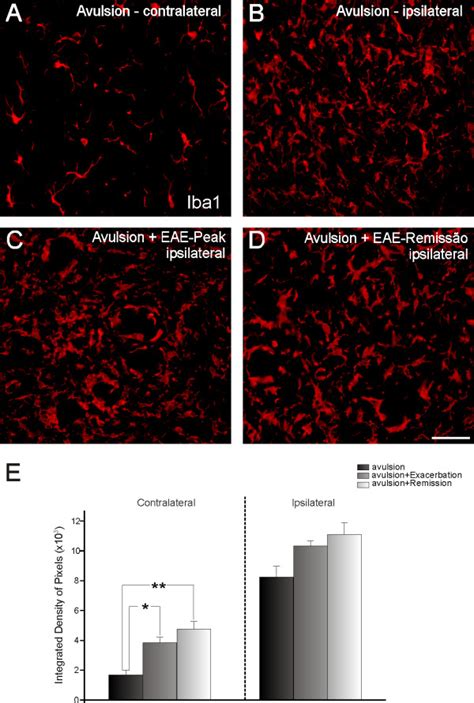 Iba Immunolabeling In Spinal Cord Ventral Horn Normal Immunolabeling