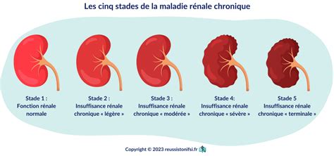 Guide Pratique Du Stage Infirmier En N Phrologie