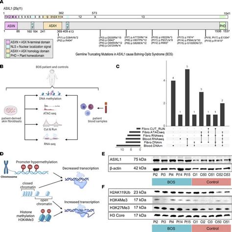 JCI Insight Multiomics Of Bohring Opitz Syndrome Truncating ASXL1