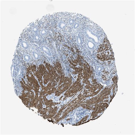 Tissue Expression Of Des Staining In Endometrium The Human Protein