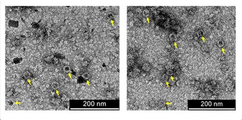 Transmission Electron Micrographs Of Purified Coupled Vlps