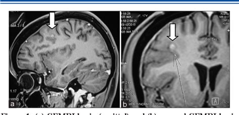 Table 1 From Radiological Screening For Neurocysticercosis In