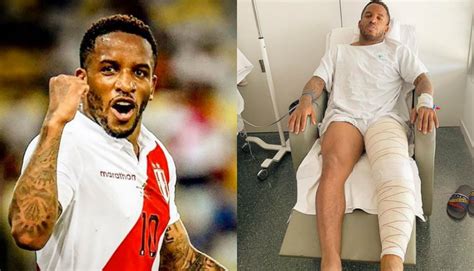 Peru vs Brasil Jefferson Farfán fue operado con éxito y envía