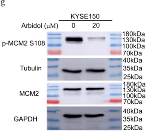 Figures And Data In Arbidol Inhibits Human Esophageal Squamous Cell