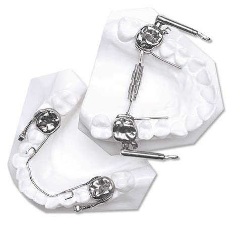 Herbst Orthodontic Appliance Dynaflex