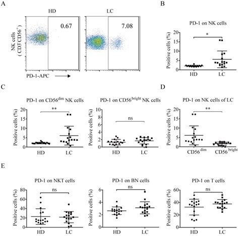 Pd Expression In Nk Cells Of Lung Cancer Patients And Healthy