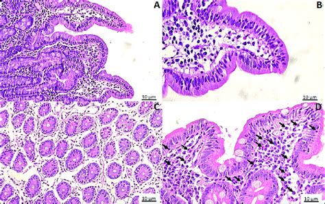 H E Photomicrographs Of Duodenal Biopsies A Tissue Obtained From A