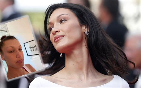 Jedna od najlepših žena sveta ima neizlečivu bolest: Bela Hadid