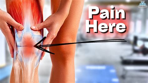 The BEST Rehab Exercises For Patella Tendinopathy YouTube