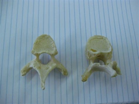 Boned: Human Skeleton - spine (vertebrae)