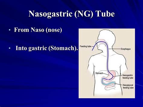 nasogastric tubes nur  nasogastric ng tube  naso nose