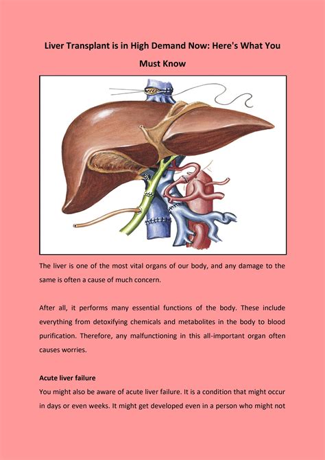 Liver Transplant Is In High Demand Now Heres What You Must Know By Mufamedi Tourism Issuu