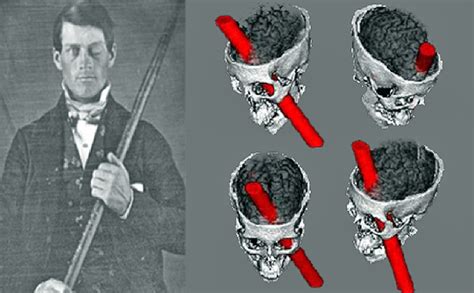The Strange Yet Instructive Case Of Mr Phineas Gage · The Online Story Bank