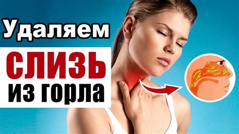 Эффективные способы избавления от слизи в горле в домашних условиях ...