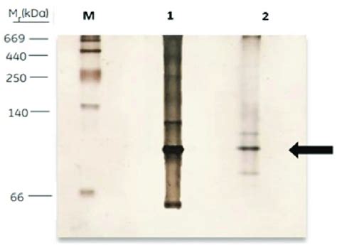 Native Polyacrylamide Gel Electrophoresis 9 M Maker Protein 1 Download Scientific