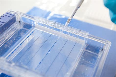 DNA gel electrophoresis stock image. Image of analysis - 22692673