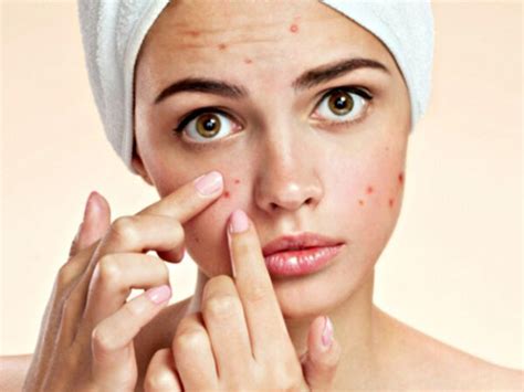 Common Summer Skin Problems And How To Deal With Them Explody Full