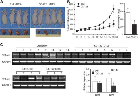 In Vivo Effects Of CC 122 On Human HCC Growth In Nude Mice Injected