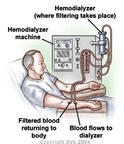 dialysis access society  vascular surgery